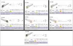 DCLNR İç Paso Kateri S32T DCKNR 12 75° CNMG 1204 K403